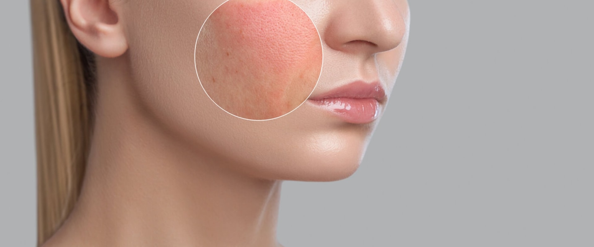 Understanding Immediate Reactions After a Facial Treatment