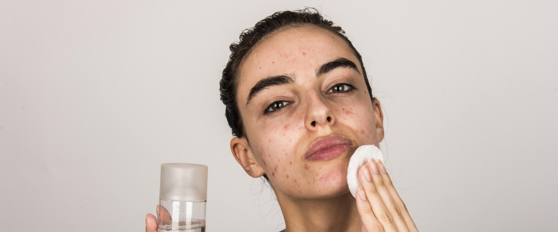 Top Facials to Manage Oily Skin Effectively