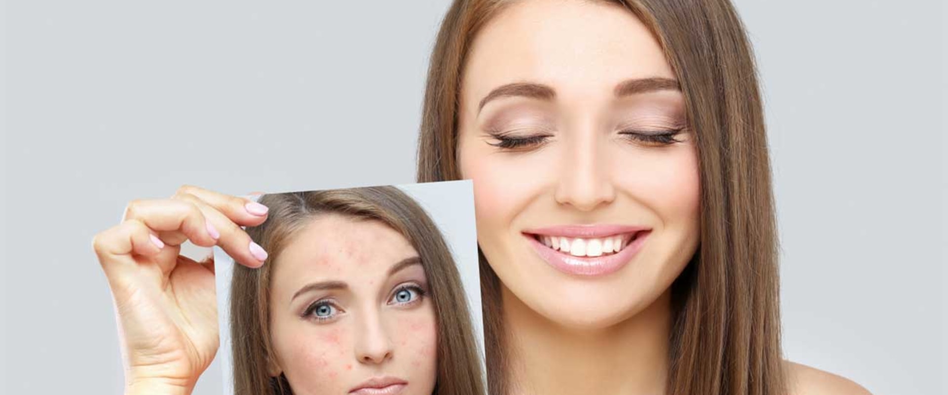 Enhancing Self-Esteem Through Radiant Skin