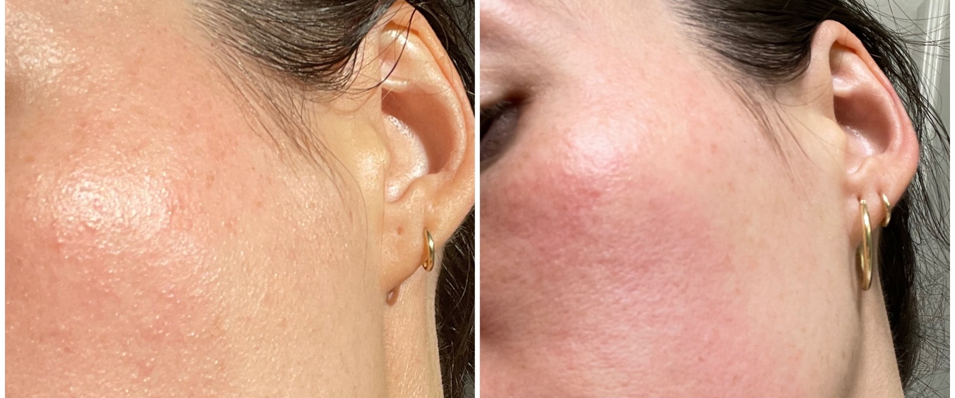 Understanding Unusual Reactions After Facial Treatments