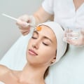 Unlocking Radiance: The Transformative Power of Chemical Peels