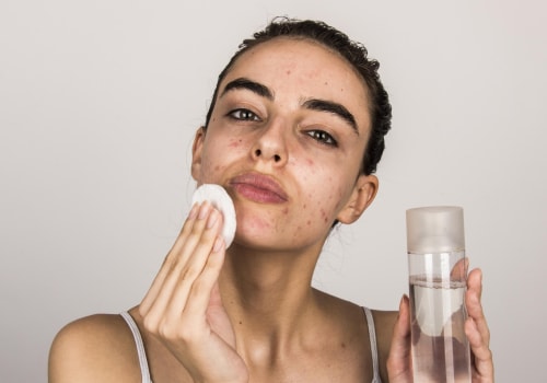 Top Facials to Manage Oily Skin Effectively