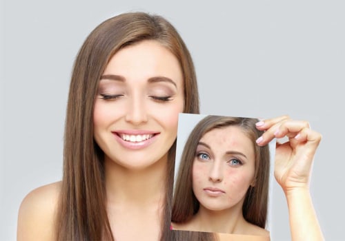 Enhancing Self-Esteem Through Radiant Skin