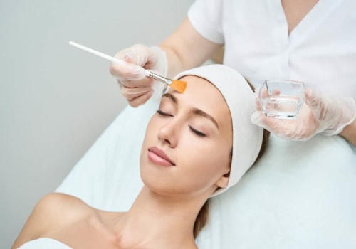 Unlocking Radiance: The Transformative Power of Chemical Peels